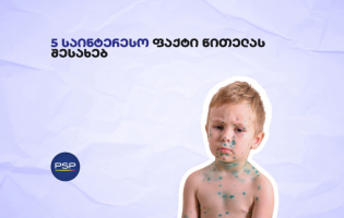 PSP: ხუთი საინტერესო ფაქტი წითელას შესახებ